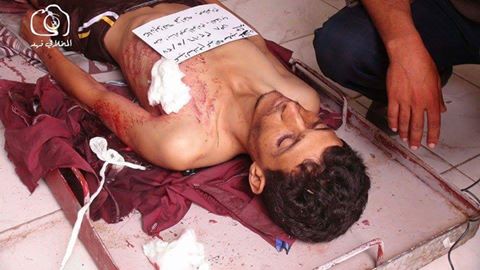 مقتل مواطن وإصابة طفلة برصاص قناصة الميلشيات في تعز