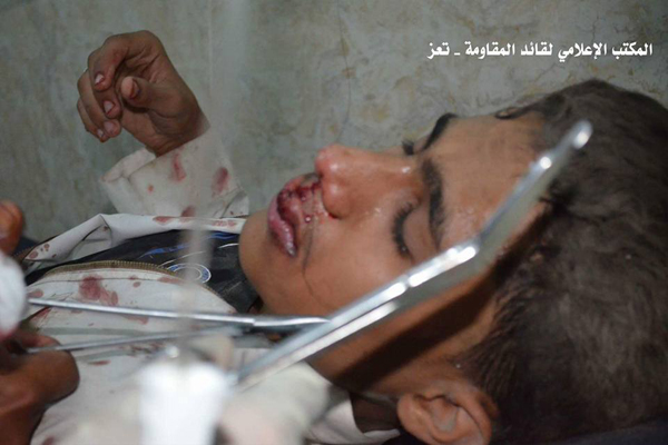 مقتل ثلاثة أطفال بقصف للحوثيين على أحياء تعز بثاني أيام رمضان