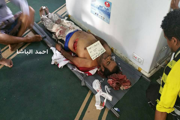 9 قتلى و26 جريحا حصيلة أولية لقصف مليشيات الحوثي وصالح بتعز