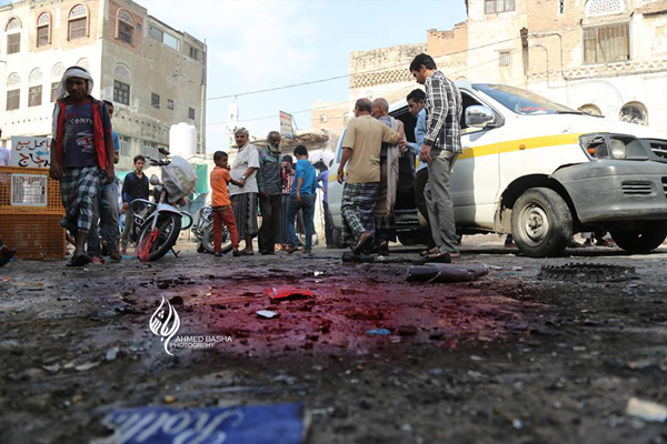 تقرير حقوقي : 264 واقعة انتهاك بينها 143حالة قتل خلال "مايو ويونيو 2016" باليمن