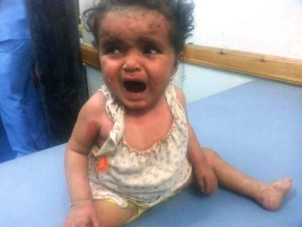 ميلشيات الحوثي وصالح تقتل 5 مدنيين من أسرة واحدة بتعز في مجزرة ثانية خلال 24ساعة