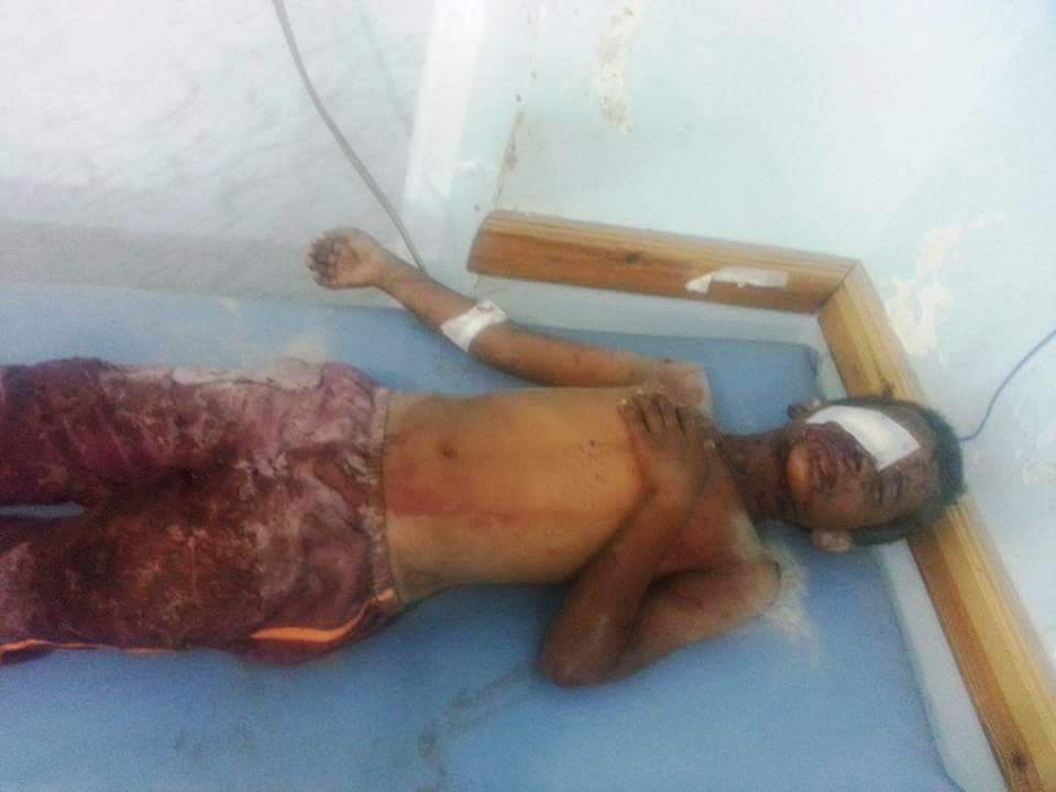 تعز :مقتل امرأة وإصابة 24آخرين معظمهم من أسره واحد بقصف للحوثيين