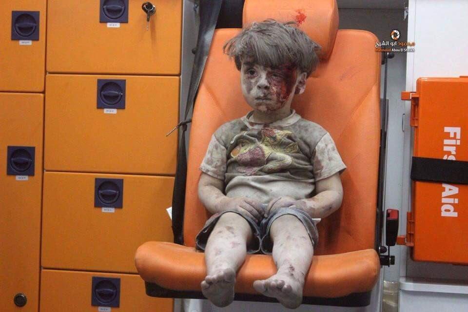 طفل أصيب بغارة على حلب يتلمس دماء وجهه (فيديو)