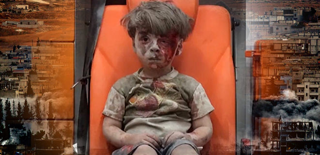 وفاة شقيق طفل حلب الذي أصابت صوره العالم بصدمة متأثرا بجروحه