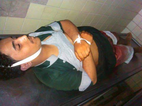إب: مليشيا الحوثي تقتل نجل عسكري يمني قاتل الاحتلال الإسرائيلي بفلسطين