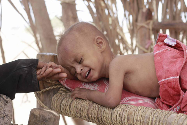 مسؤول أممي: خطر المجاعة يهدد اليمن خلال العام الجاري ماينذر بكارثة