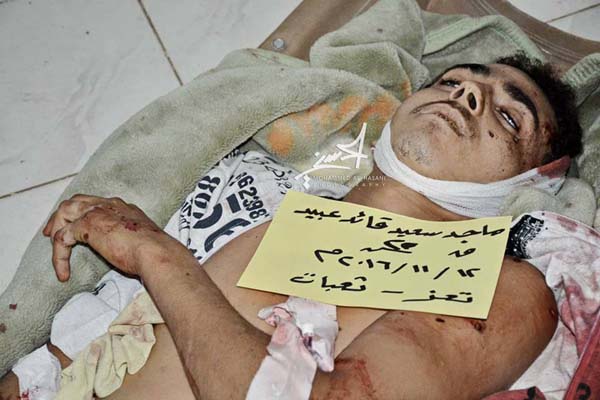 تعز: مقتل 3 وإصابة 4 مدنيين بقصف للحوثيين