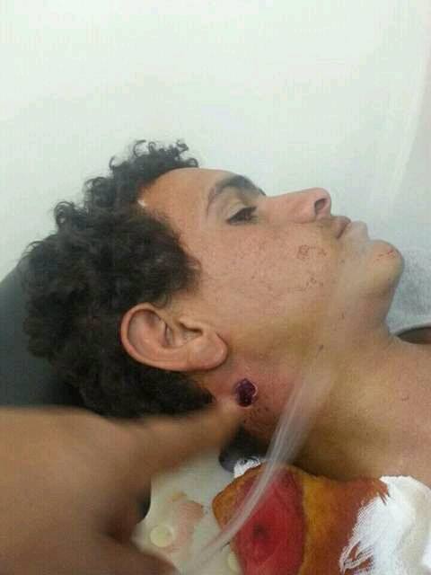 الضالع: إصابة مواطن برصاص قناص حوثي غرب مريس
