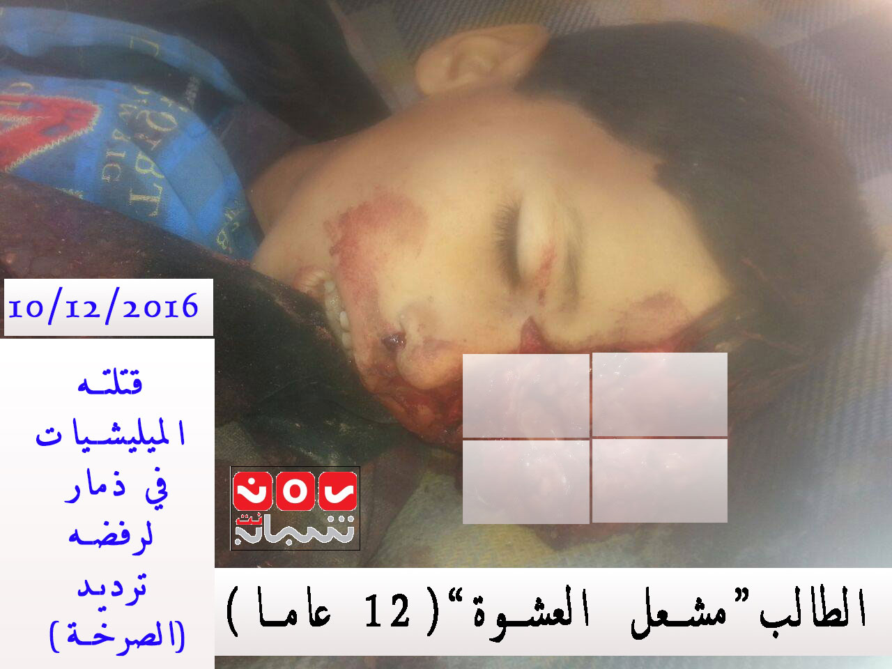 ذمار: ميليشيات الحوثي تقتل طالبا رفض ترديد (الصرخة) في مدرسة بـ"الحدأ"