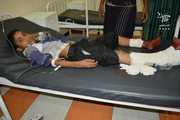 تعز: مقتل وإصابة خمسة مدنيين بنيران مليشيا الحوثي والمخلوع