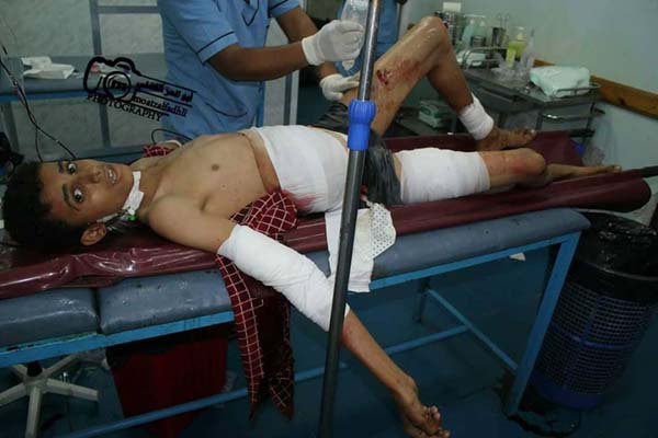 مقتل و إصابة 9 مدنيين بمجزرة جديدة لمليشيا الحوثي والمخلوع بتعز