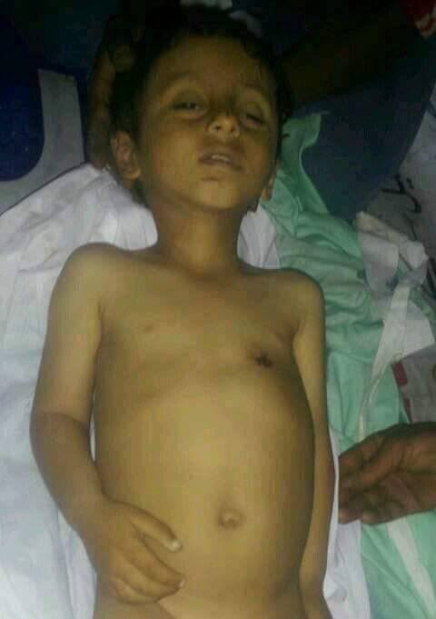 إب: مقتل طفل في أحد الأعراس "بوراف" جنوب غرب المحافظة