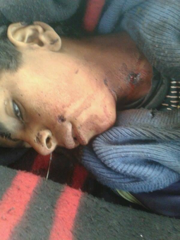البيضاء: مقتل طفل  وإصابة ثلاثة آخرين في قصف مدفعي للحوثيين بمديرية بالزاهر