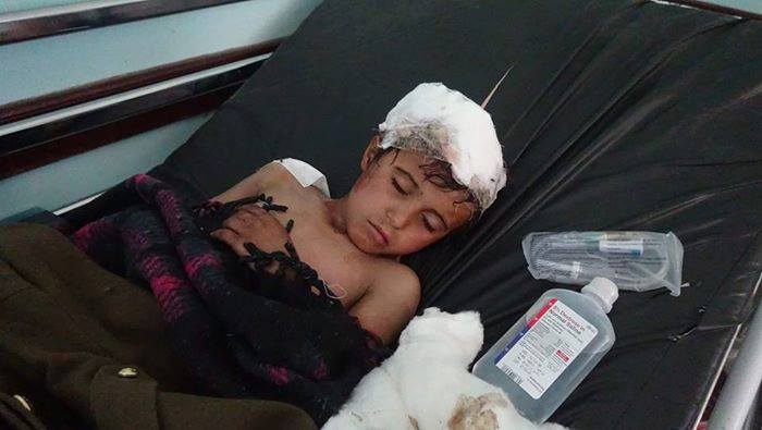 مقتل طفل واصابة اخرين في قصف مليشيا الحوثي على مخيم الخانق "بنهم"