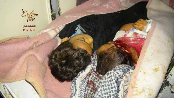 تعز: مقتل ثلاثة أطفال بقصف مليشيا الحوثي وصالح على وسط مدينة (صور)