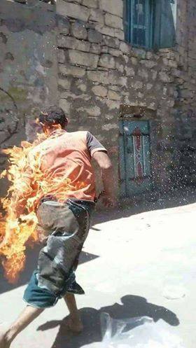 إب: حوثيون يضرمون النار في جسد مختل عقلي بالسياني