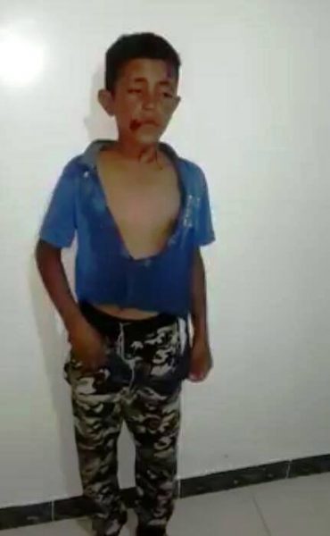 البيضاء: مليشيا الحوثي تختطف طفل وتعذبه ثم ترميه بين القمامة بذي ناعم