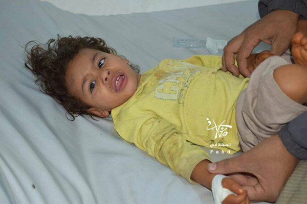  تعز: مقتل وإصابة 4 مدنيين بقصف مليشيا الحوثي والمخلوع  