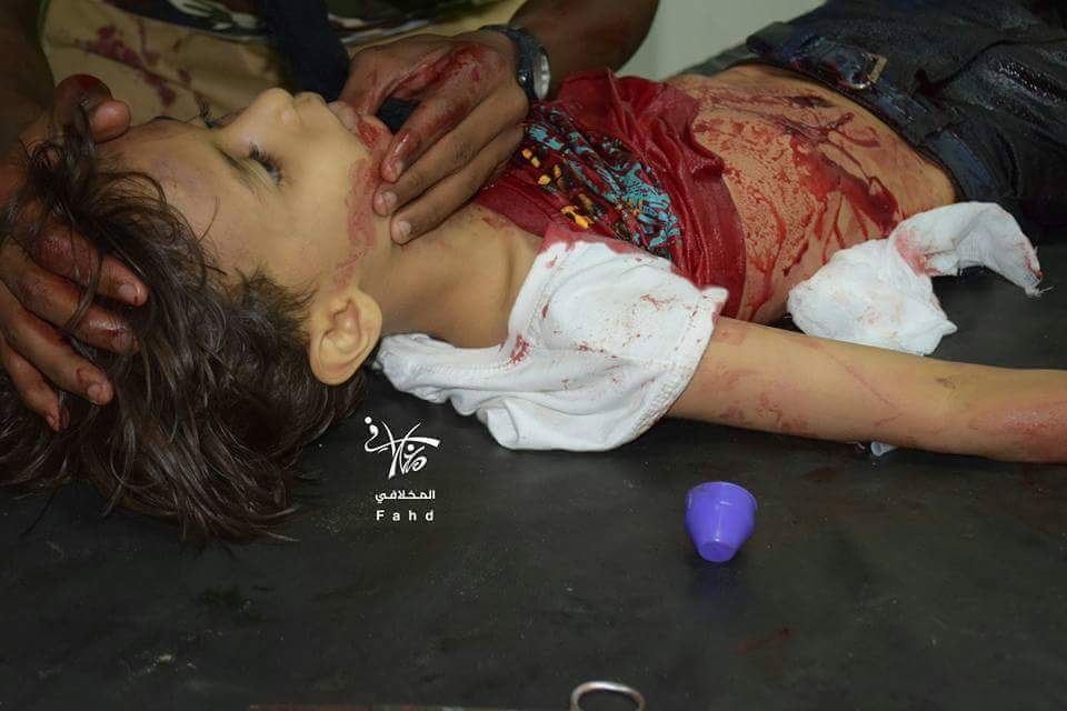مصدر طبي لـ"يمن شباب نت": مقتل 6 مدنيين بقصف ميليشيات الحوثي على حي سكني بتعز