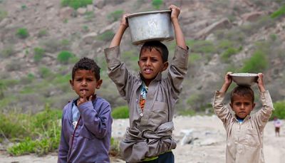 مركز بحوث التنمية الاقتصادية: 1.8 مليون طفل يمني يعانون سوء التغذية الحاد