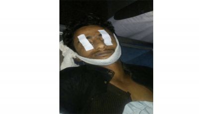 إب.. وفاة سجين في ظروف غامضة بأحد سجون الحوثيين الخاصة