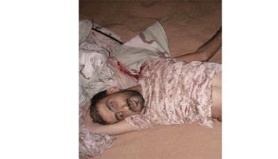 مقتل عقيد في الجيش وتسعة حوثيين بينهم قيادي في مواجهات بشبوة