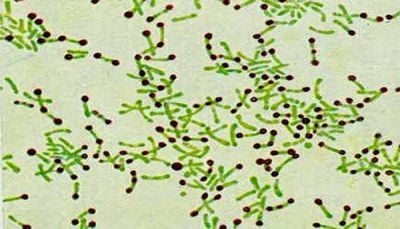 وزارة الصحة تدشّن حملة للتحصين ضد الدفتيريا في 11 محافظة