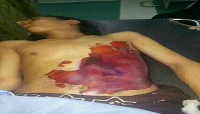 إب: عصابات حوثية تقتل شاباً في "المخادر" ومعلم في "السبرة" 