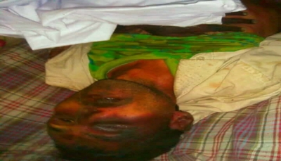 إب: مليشيا الحوثي تعذب أحد المختطفين في سجونها حتى الموت