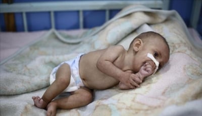 يونيسيف: 3 ملايين طفل ولدوا خلال الحرب باليمن