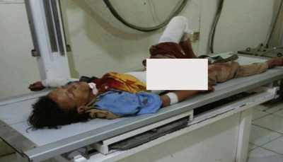 إصابة ثلاثة أطفال بجروح خطيرة جراء قصف حوثي في مريس بالضالع
