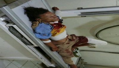 الضالع: إصابة طفلين بشظايا قصف مليشيات الحوثي على القُرى غرب مُريس