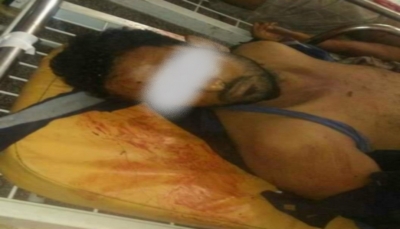 الضالع: قتلى وجرحى في استهداف مبنى المحافظة واشتباكات بين قوات الحزام ومسلحين