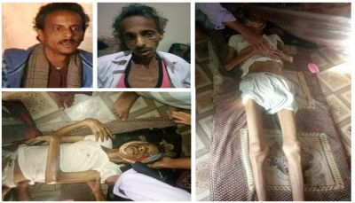 غضب واستهجان شعبي لوفاة الصحفي "الركن" جراء التعذيب.. والنقابة تحمل الحوثيين كامل المسئولية