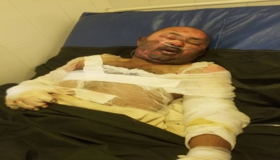 وفاة مواطن وإصابة آخر بحروق بليغة في انفجار إسطوانة غار بـ"إب"