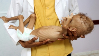 منظمة حقوقية: الحُديدة "مركز" تفشّي الكوليرا في اليمن