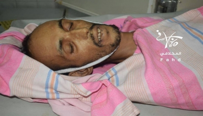وفاة مختطف تحت التعذيب في سجون الحوثي بتعز