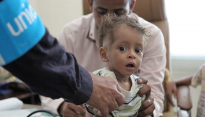 اليونيسيف تعلن معالجة 170 ألف طفل من سوء التغذية الشديد في اليمن