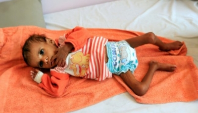 أطفال اليمن في مواجهة المجاعة مع استمرار الحرب للعام الرابع