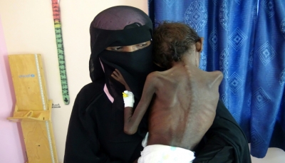 منظمات أممية تقول إن انعدام الأمن الغذائي في اليمن يؤثر على 20 مليون شخص