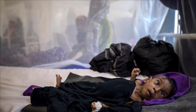 385 حالة إصابة.. "إنفلونزا الخنازير" وباء جديد يتفشى في اليمن