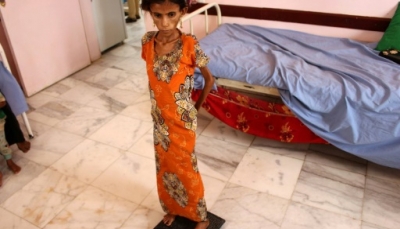 الأمم المتحدة: مقتل وإصابة ثمانية أطفال يوميا في اليمن رغم الهدنة
