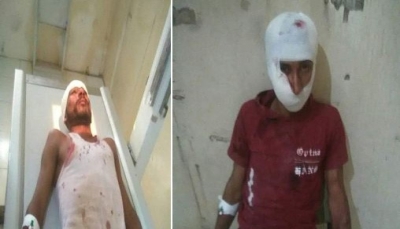 إصابة سبعة مدنيين بقصف حوثي استهدف قرية بيت الشوكي بالضالع