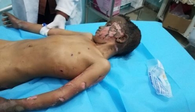 مقتل وإصابة خمسة مدنيين بينهم أطفال في قصف للحوثيين بالجوف