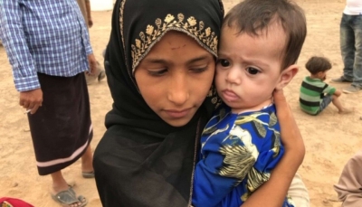 مسؤول أمريكي: الحكم الحوثي يزيد الوضع الإنساني المتدهور سوء ويوسع السخط الشعبي