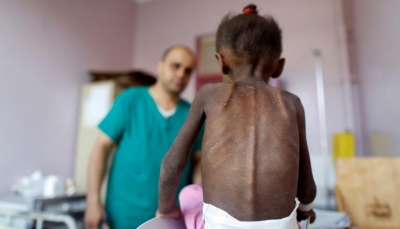 يونيسيف: 16 مليون طفل ضحايا سوء التغذية بالشرق الأوسط وشمال أفريقيا