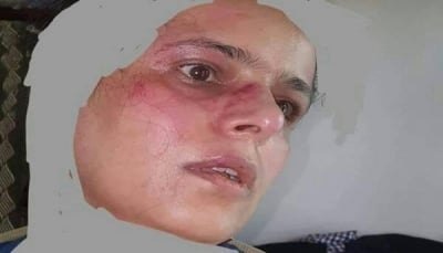 صنعاء: ميليشيا الحوثي تعتدي بالضرب المُبرح على ناشطة داخل منزلها