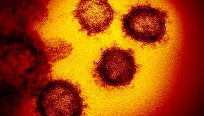 دراسة تكشف عن "مناعة مسبقة" لدى الأشخاص الذين لم يصابوا بكورونا