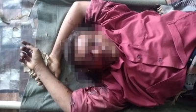 الحديدة: مقتل طفلة قنصا وشابا بانفجار لغم زرعه الحوثيون في مديرية حيس