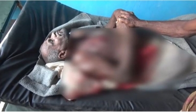 الحديدة: مقتل مُسن برصاص مليشيات الحوثي في مديرية "حيس"